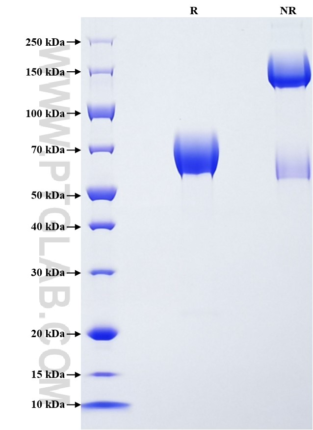 Purity of Recombinant Human IL10RB was determined by SDS-PAGE. The protein was resolved in an SDS-PAGE in reducing (R) and non-reducing (NR) conditions and stained using Coomassie blue.