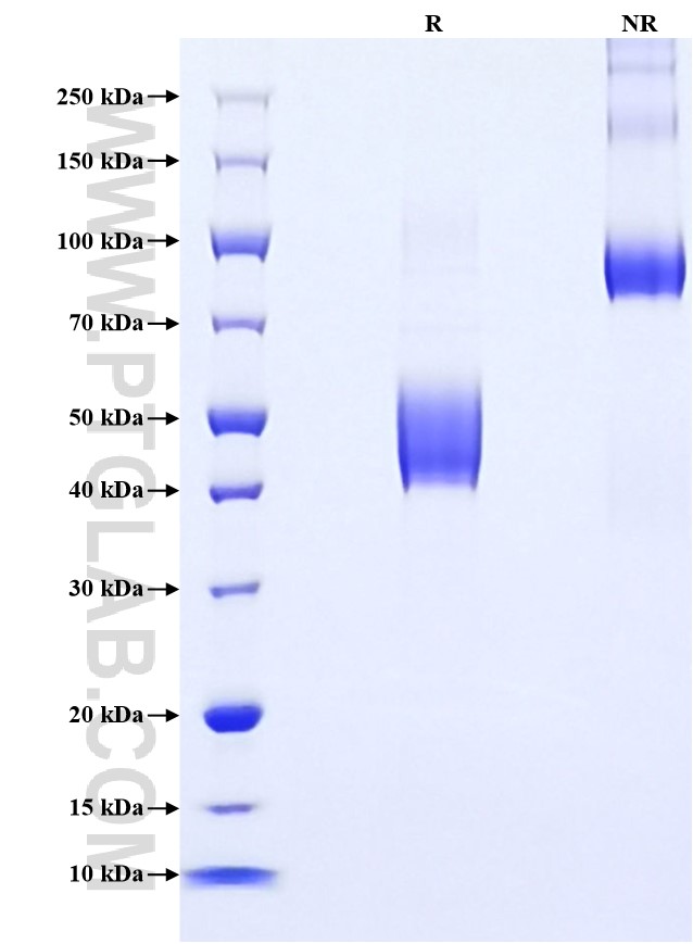 Purity of Recombinant Mouse IL-4 was determined by SDS-PAGE. The protein was resolved in an SDS-PAGE in reducing (R) and non-reducing (NR) conditions and stained using Coomassie blue.