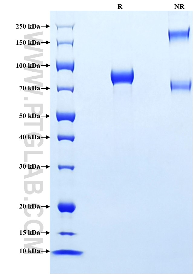 Purity of Recombinant Human Complement factor H was determined by SDS-PAGE. The protein was resolved in an SDS-PAGE in reducing (R) and non-reducing (NR) conditions and stained using Coomassie blue.