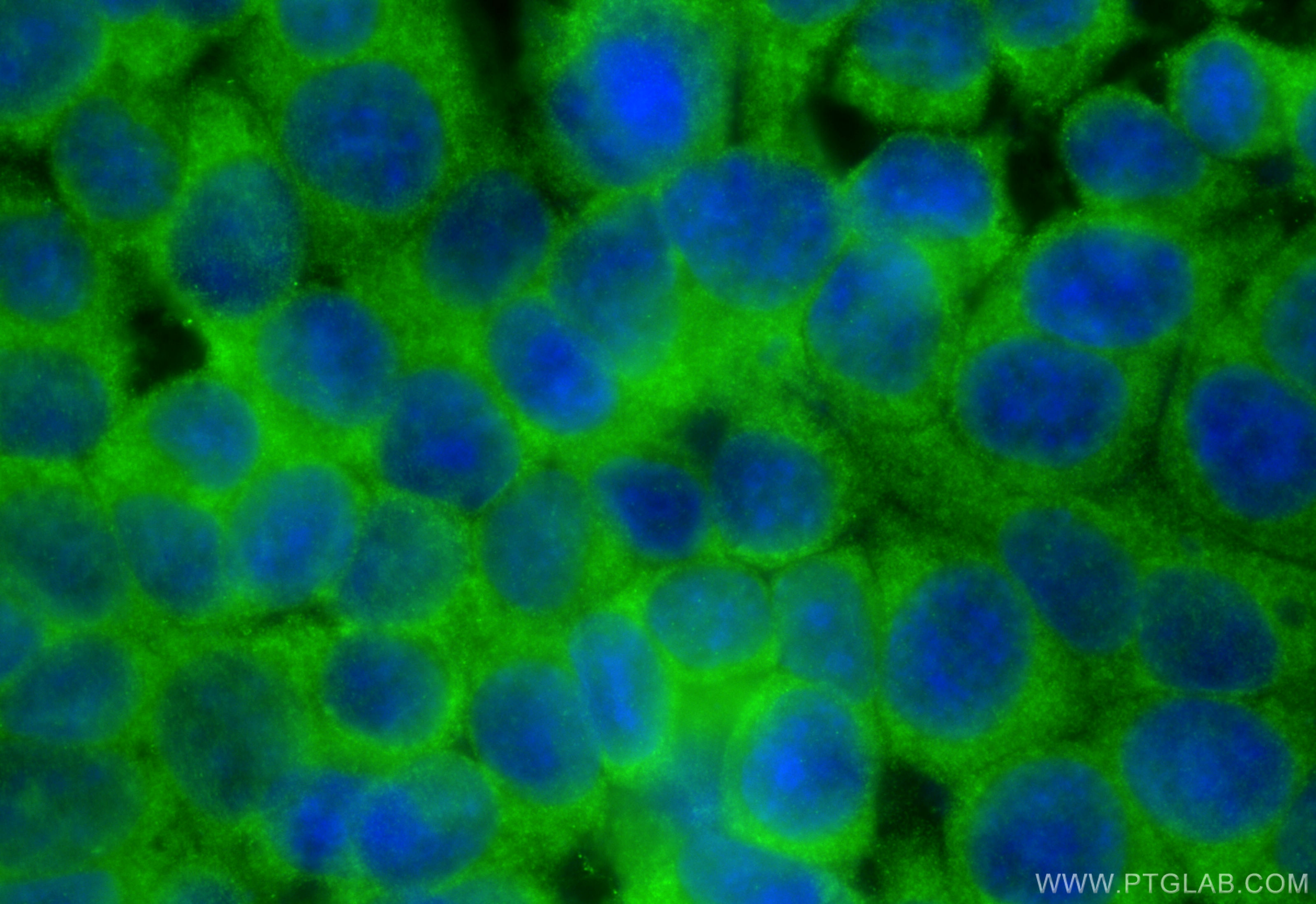 IF Staining of MCF-7 using 10675-1-AP