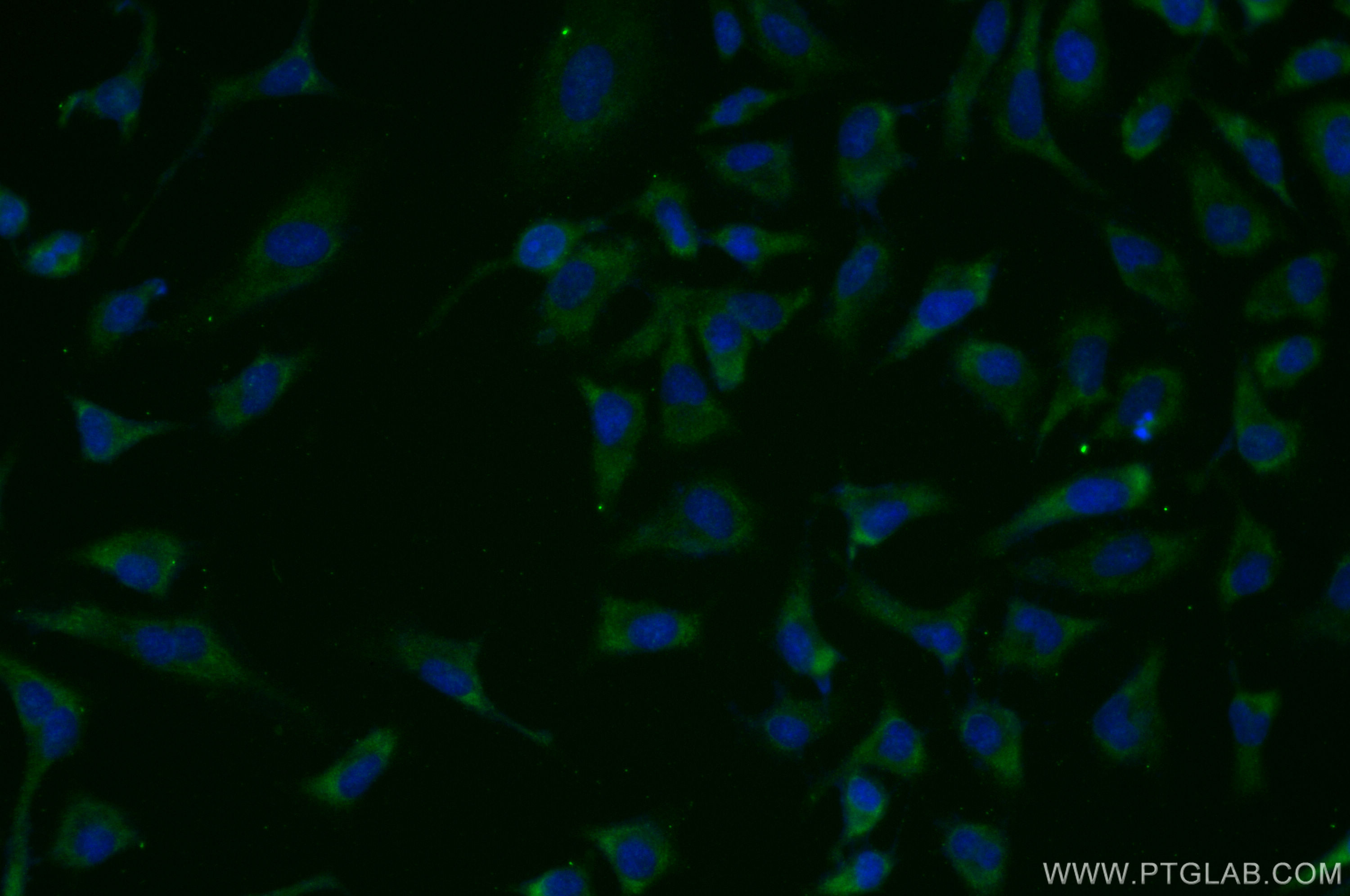 IF Staining of HeLa using 51137-1-AP