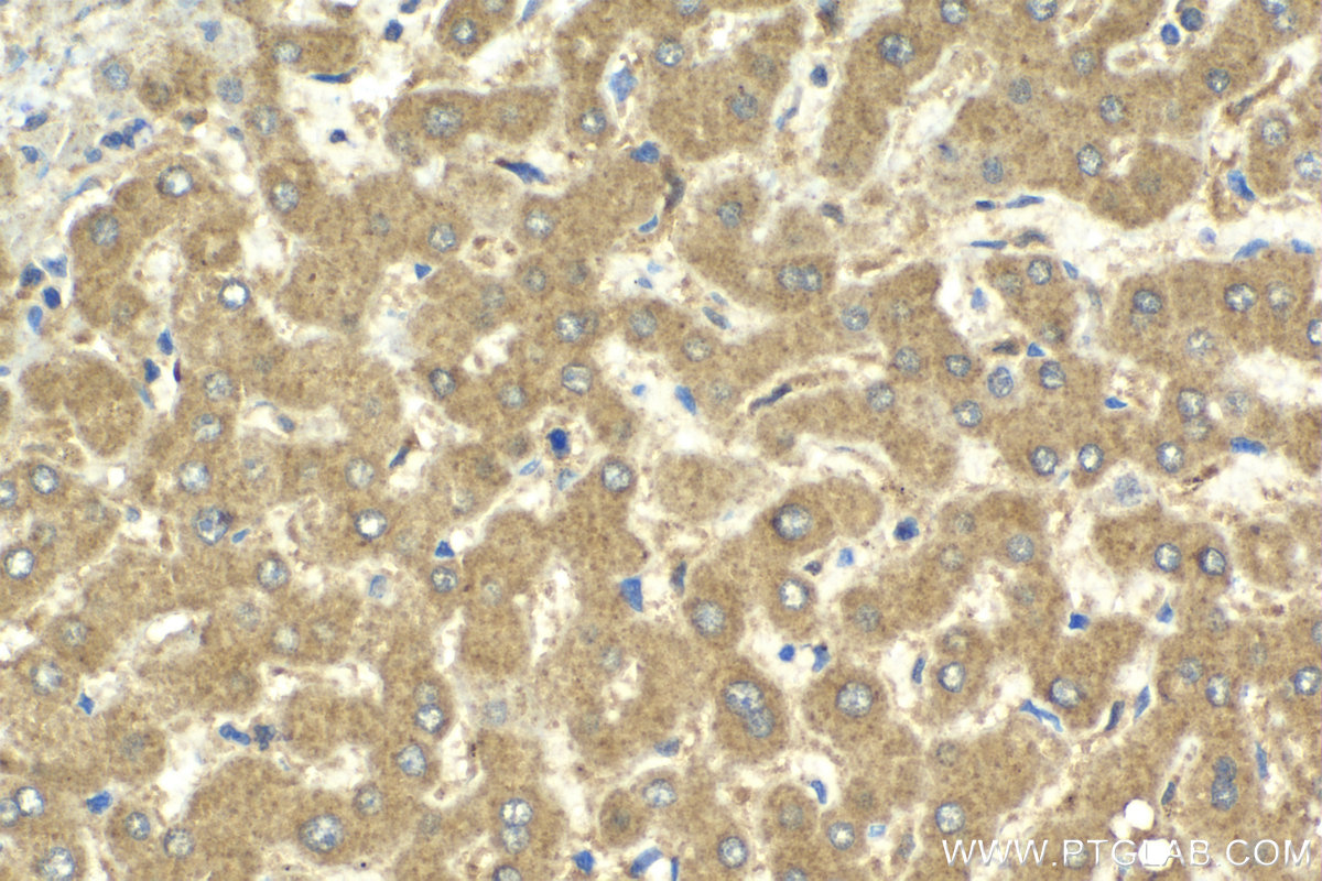 IHC staining of human liver using 14685-1-AP