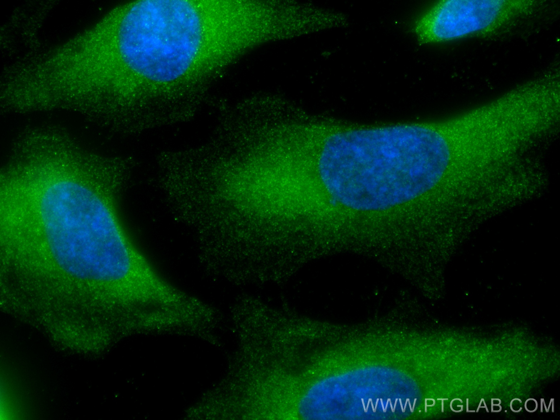 IF Staining of HeLa using 68298-1-Ig (same clone as 68298-1-PBS)