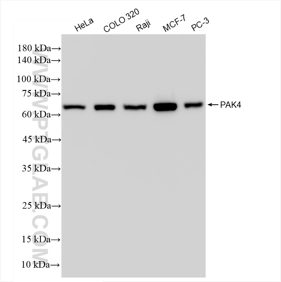 WB analysis using 83761-5-RR (same clone as 83761-5-PBS)