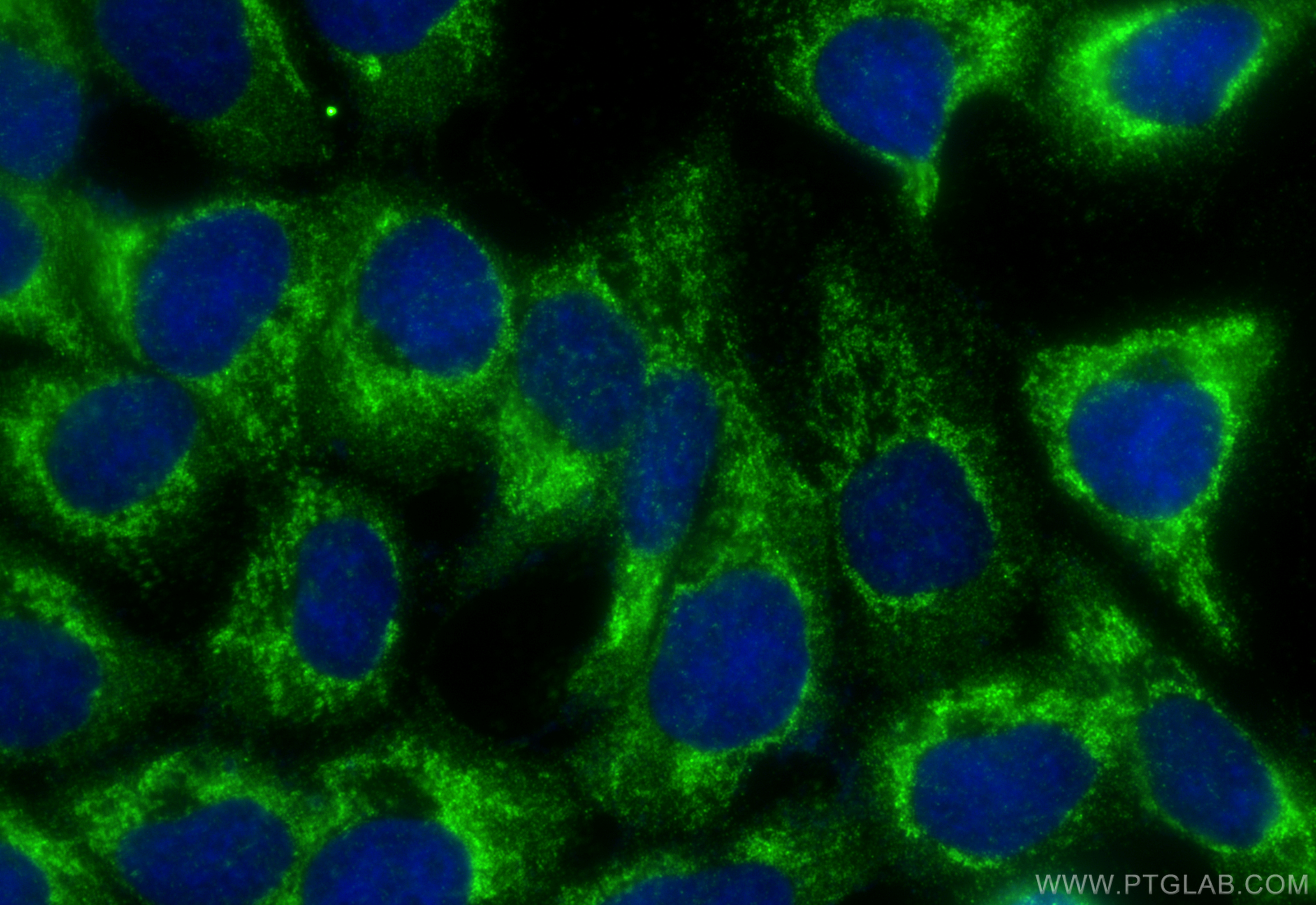 IF Staining of A431 using 13539-1-AP