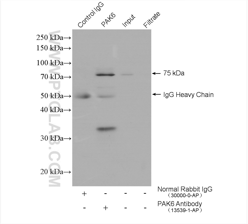 IP experiment of mouse testis using 13539-1-AP