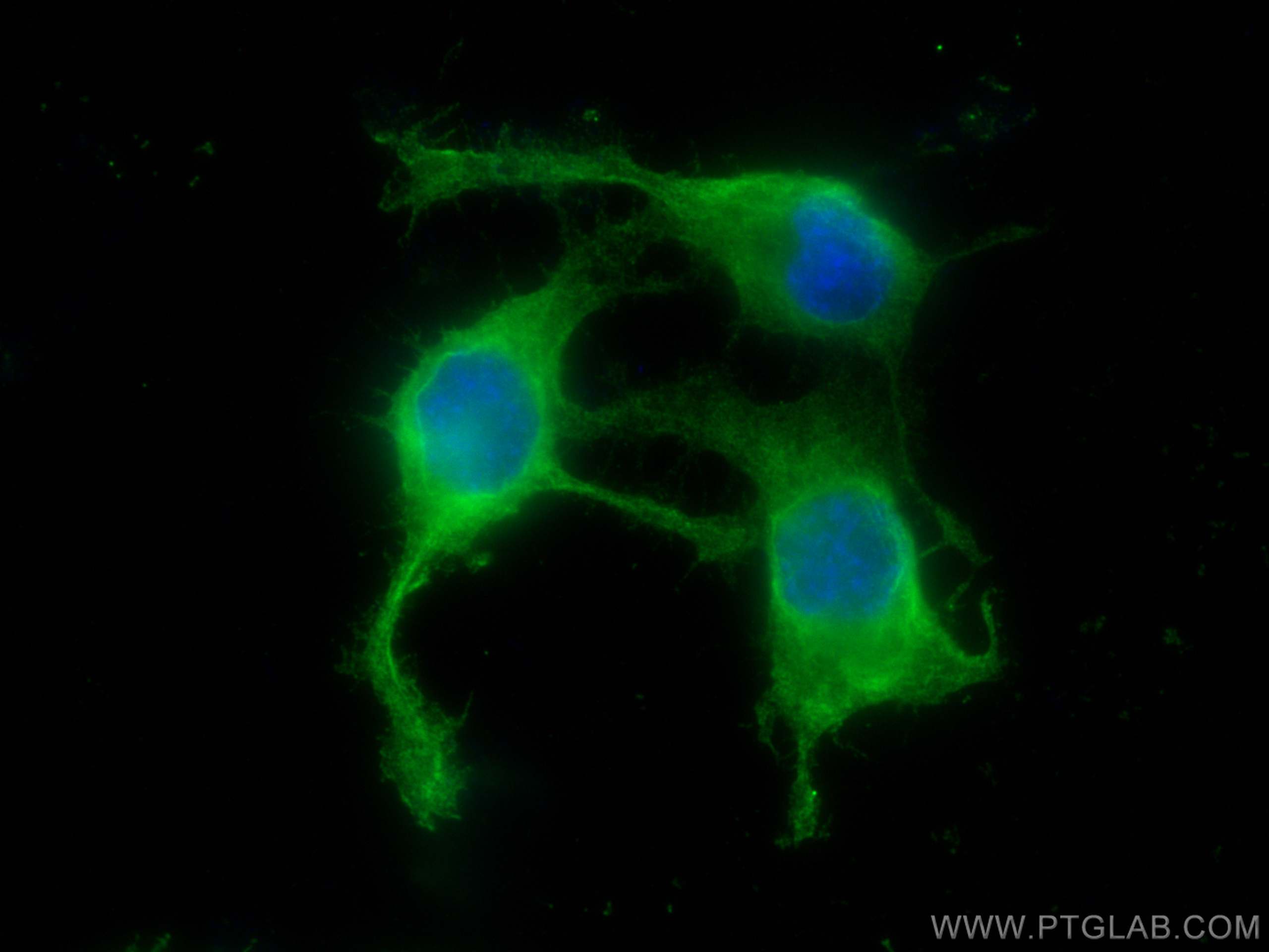 IF Staining of Neuro-2a using 66961-1-Ig