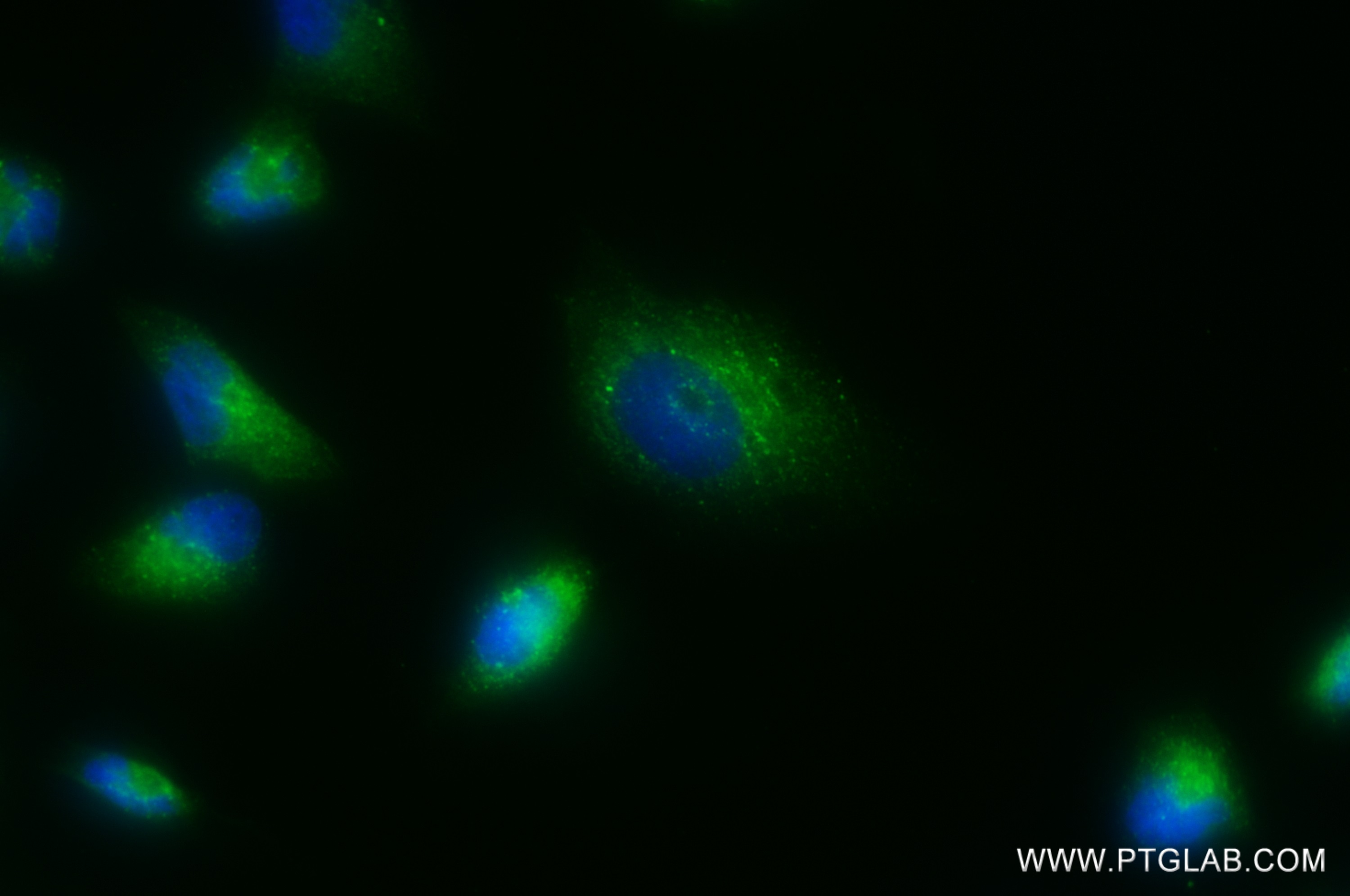 IF Staining of U-251 using 82935-1-RR (same clone as 82935-1-PBS)