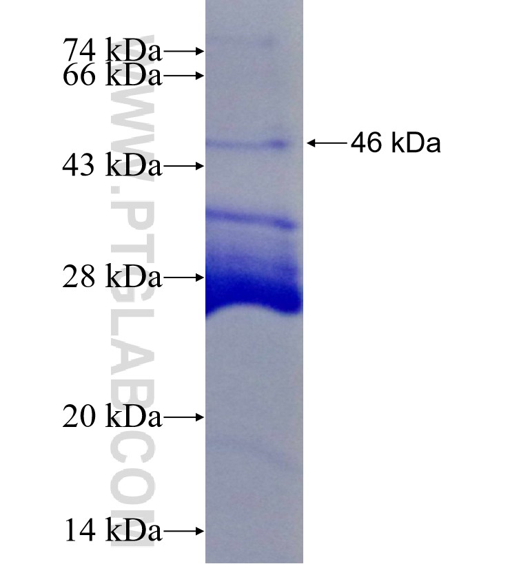 PAK7 fusion protein Ag29190 SDS-PAGE