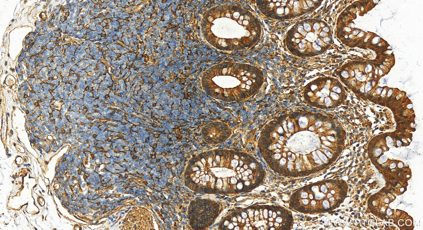 IHC staining of human colon using 10853-1-AP