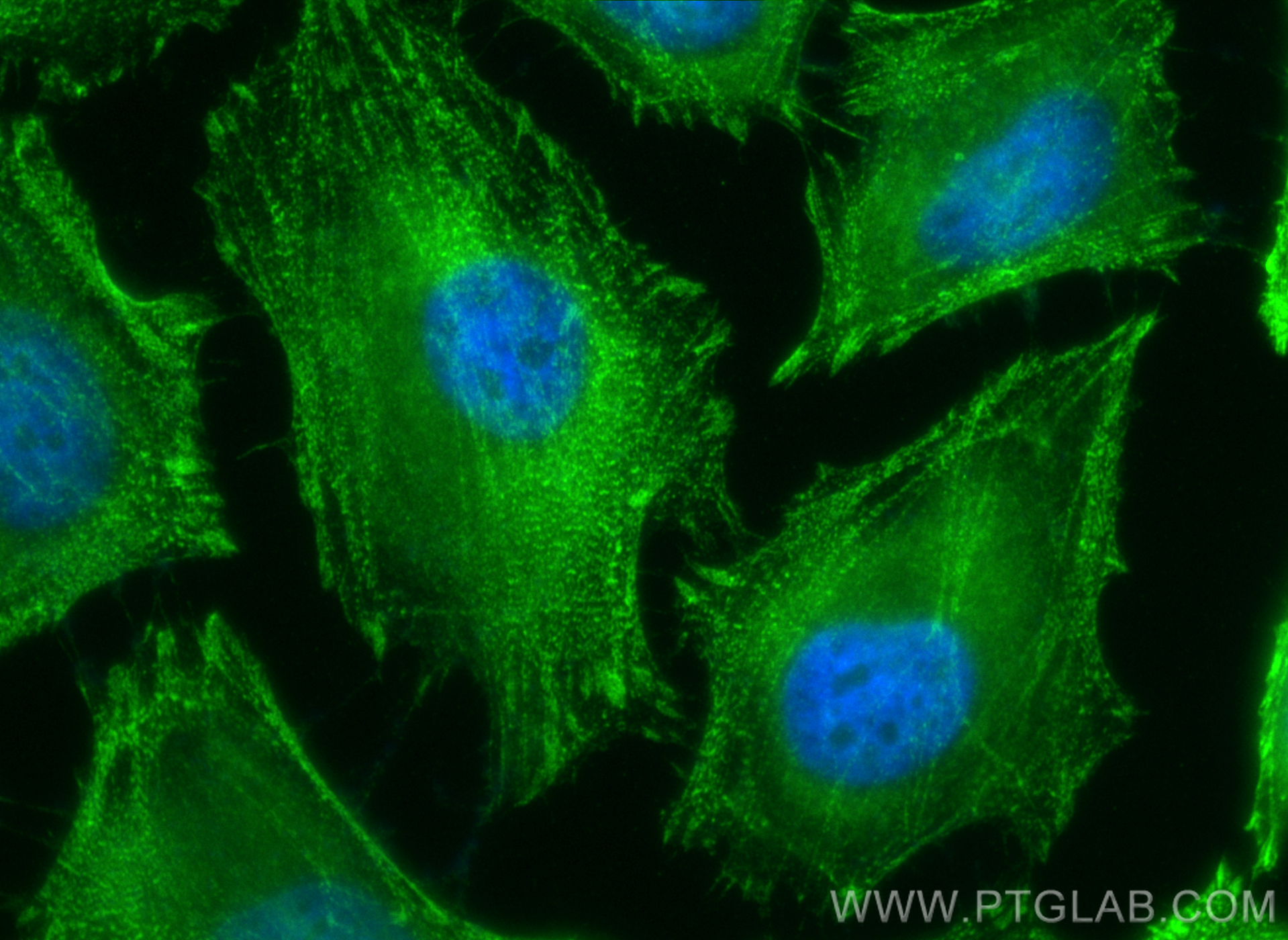 IF Staining of HeLa using 10853-1-AP