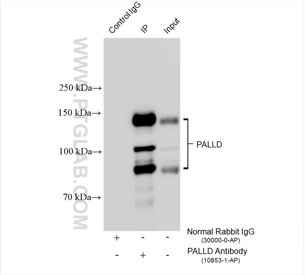 IP experiment of HeLa using 10853-1-AP