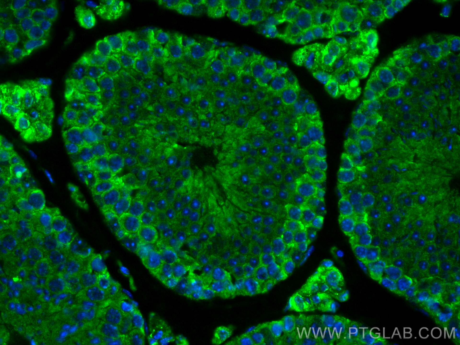 IF Staining of mouse testis using 66601-1-Ig
