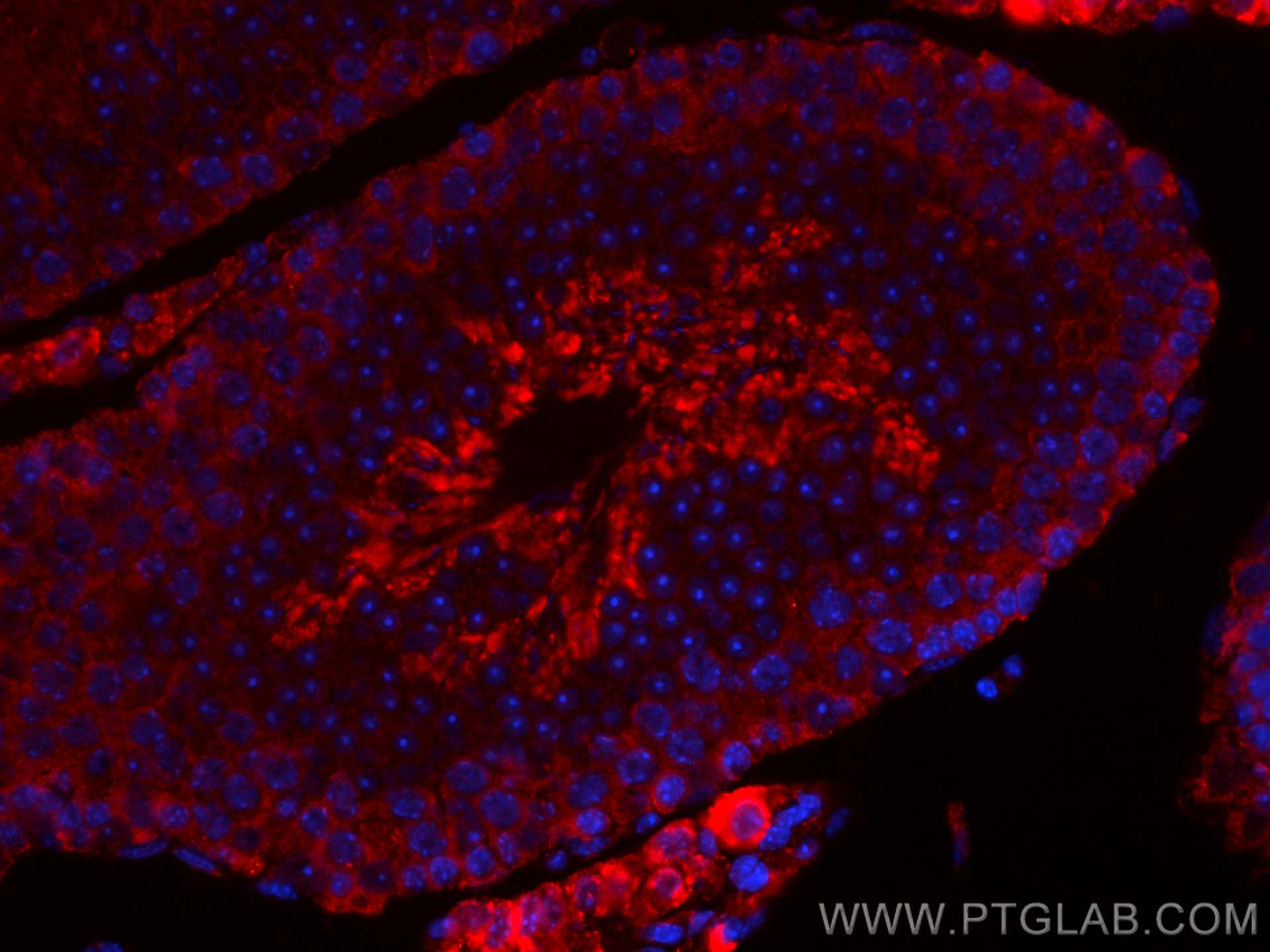 IF Staining of mouse testis using CL594-66601