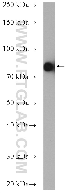 WB analysis of HeLa using 16531-1-AP