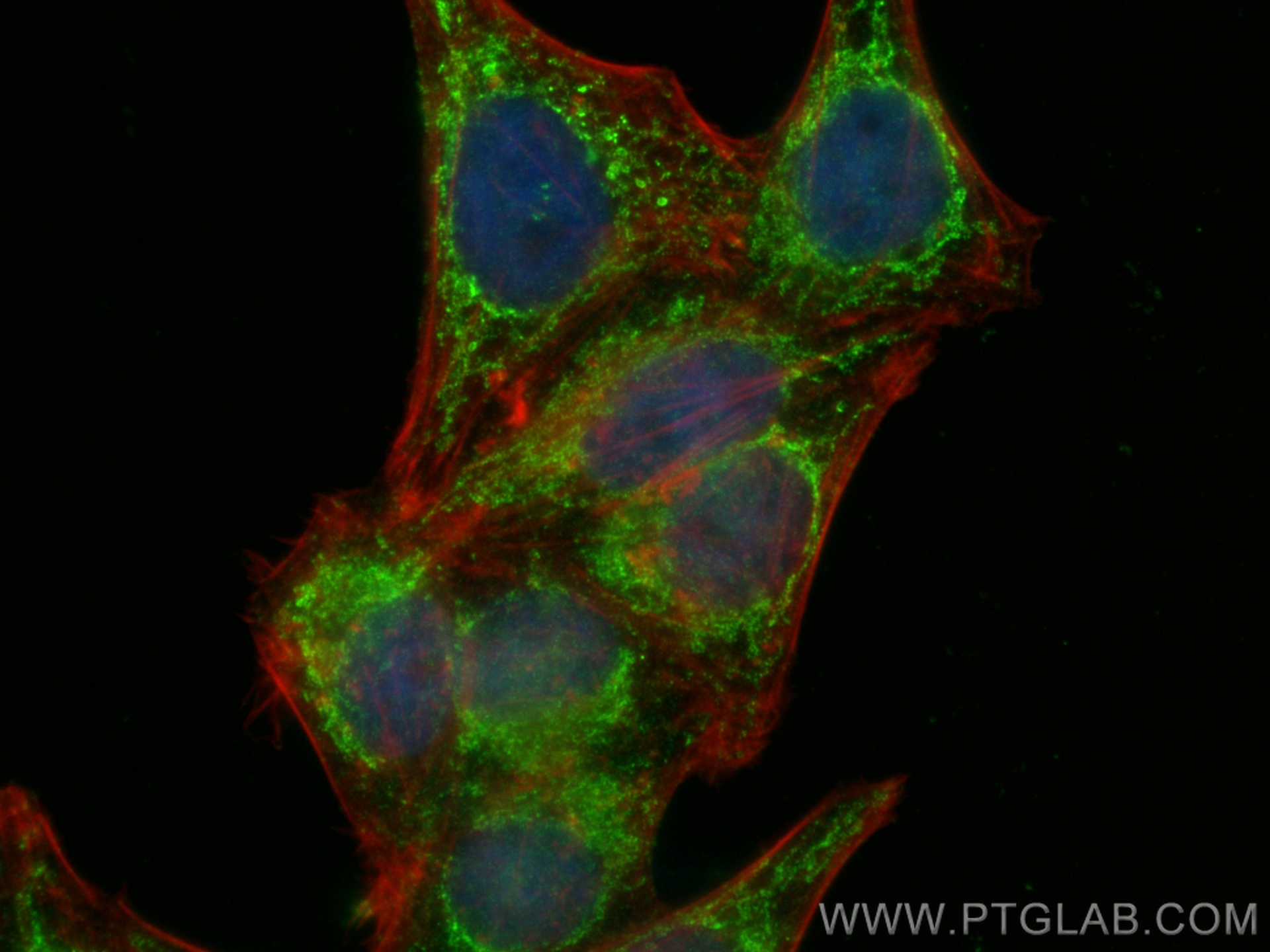 IF Staining of HepG2 using 11001-1-AP