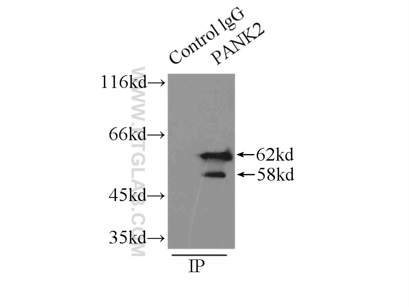 IP experiment of mouse brain using 11001-1-AP