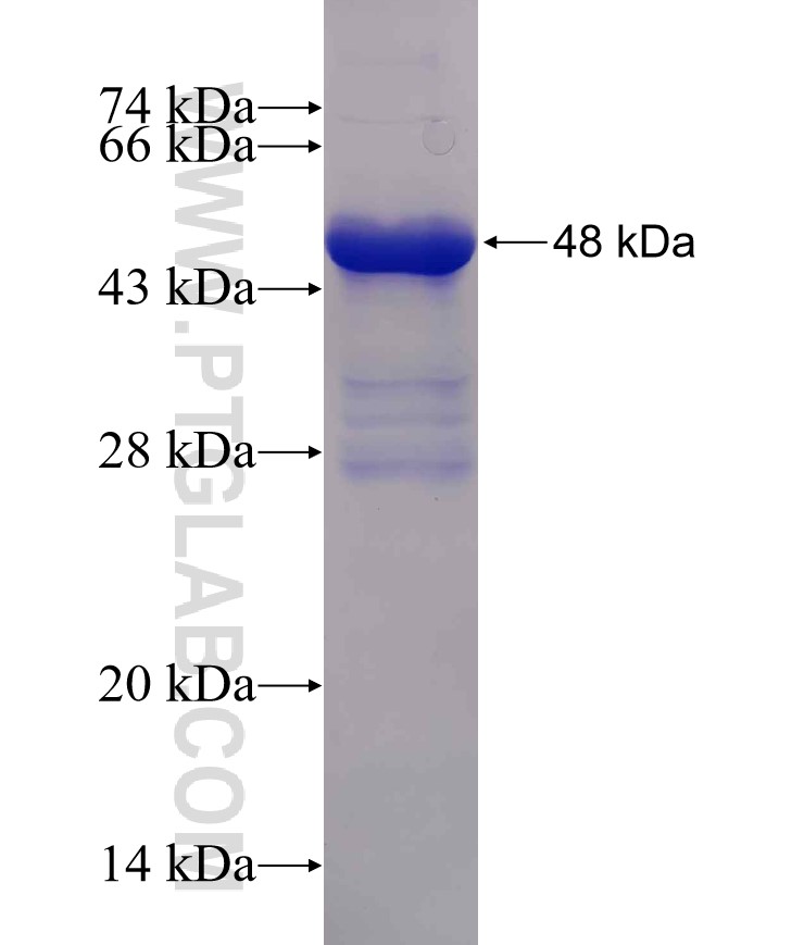 PANK2 fusion protein Ag1413 SDS-PAGE