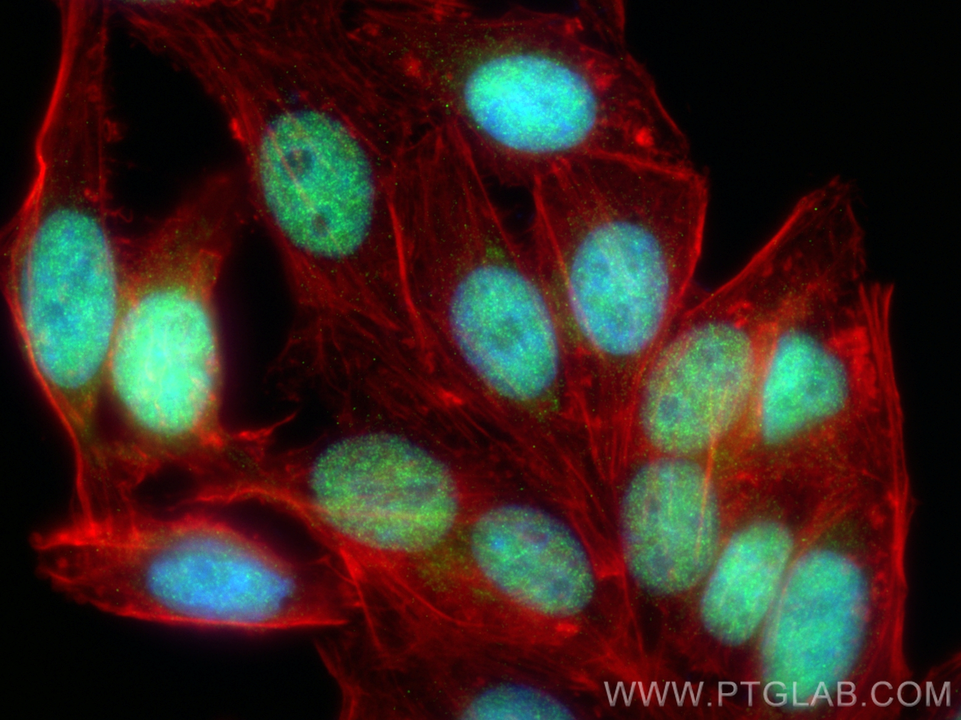 IF Staining of HepG2 using 24284-1-AP