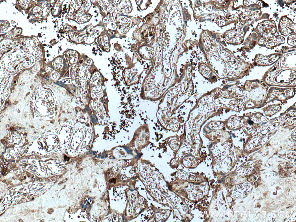 IHC staining of human placenta using 66962-1-Ig (same clone as 66962-1-PBS)