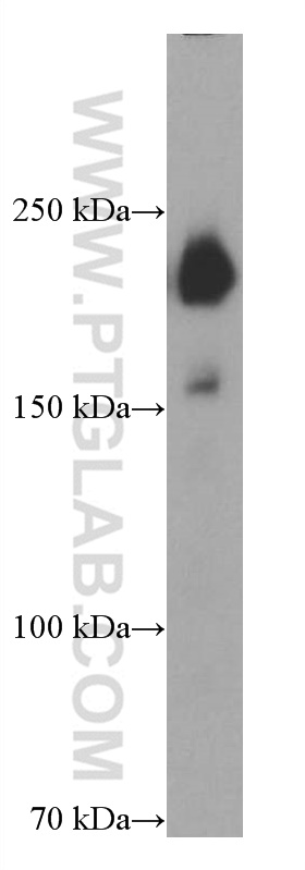 WB analysis of human placenta using 66962-1-Ig (same clone as 66962-1-PBS)