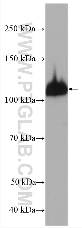 WB analysis of K-562 using 27808-1-AP