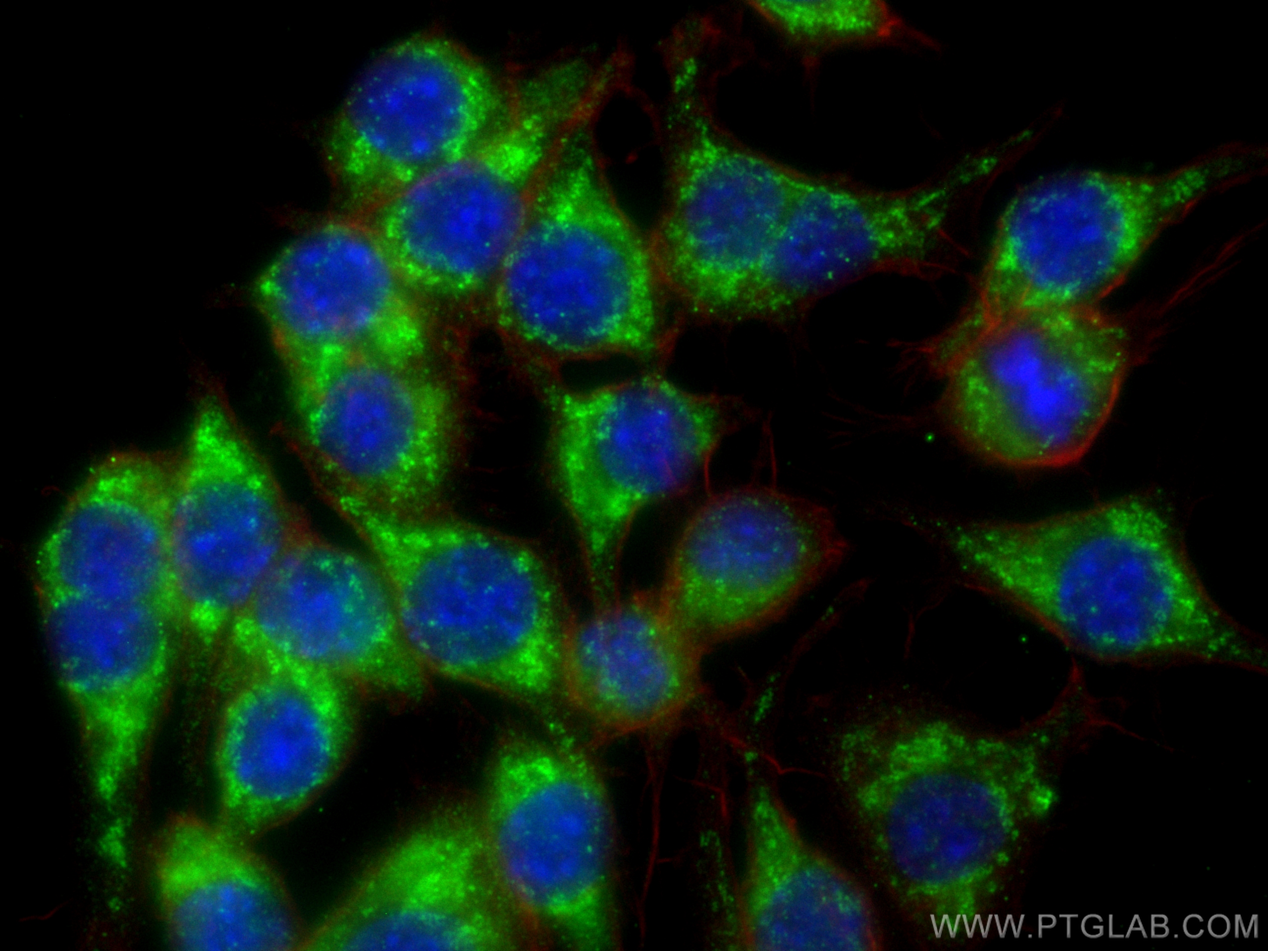 IF Staining of RAW 264.7 using 14060-1-AP