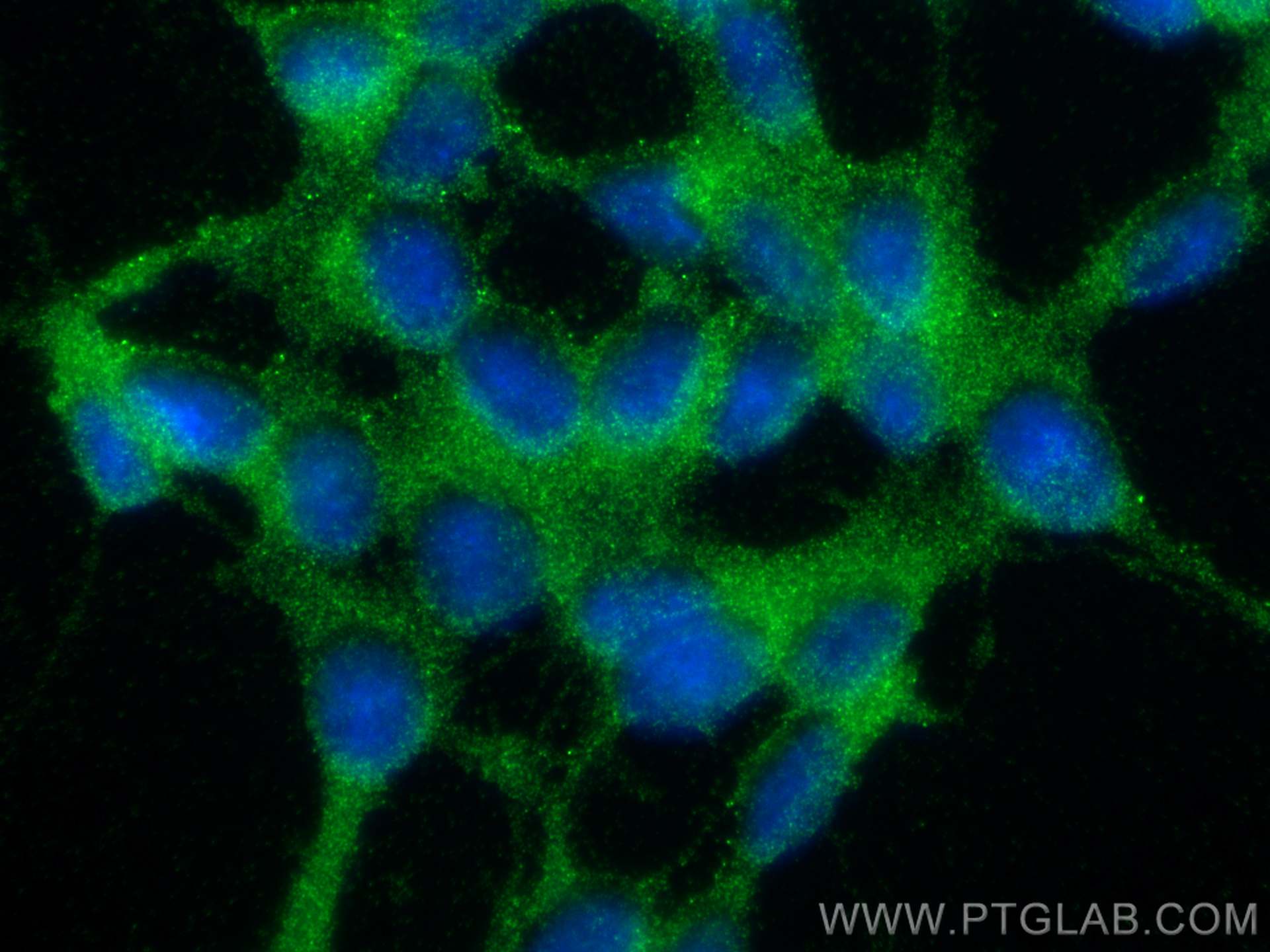 IF Staining of SH-SY5Y using 11681-1-AP