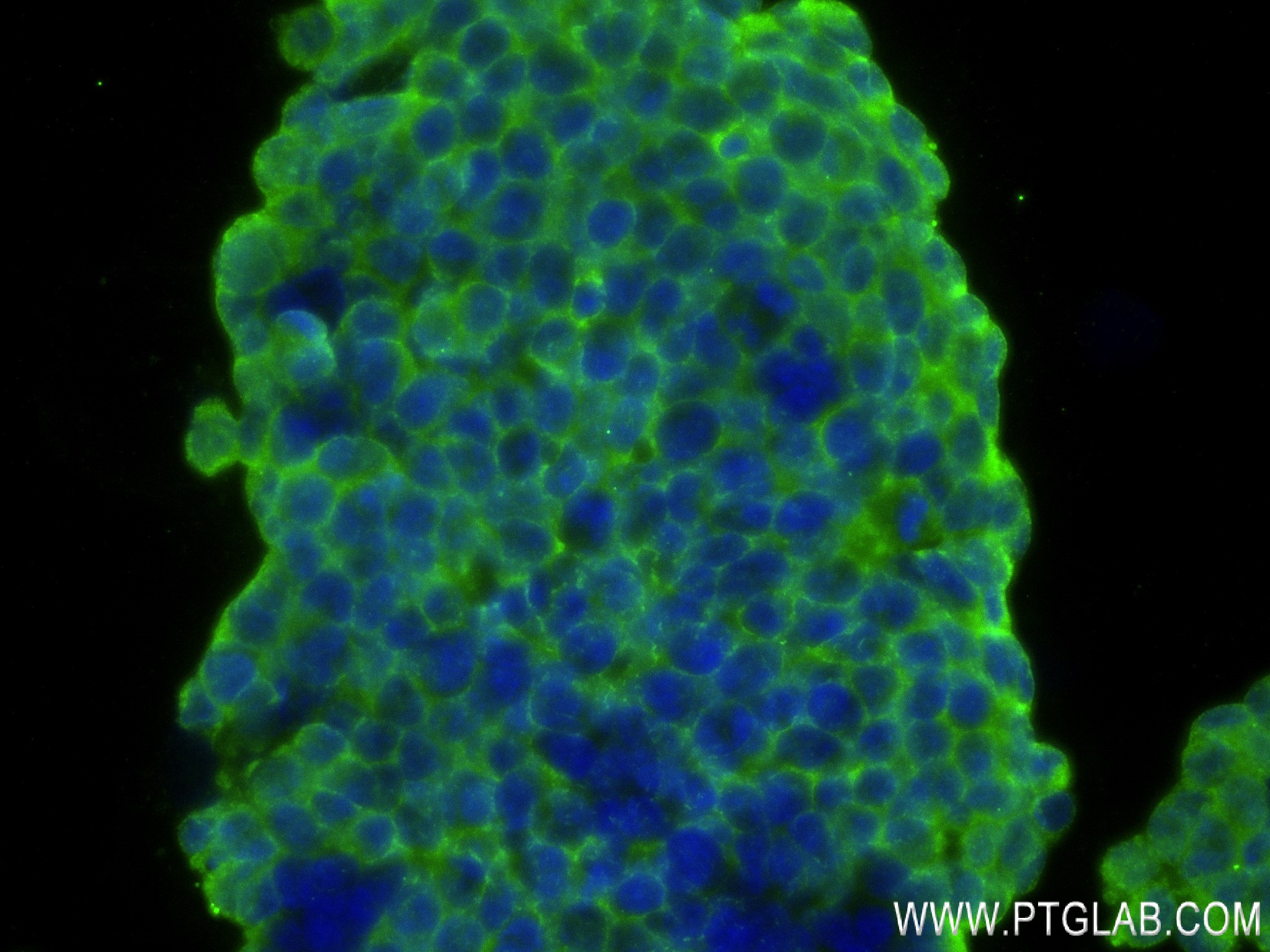 IF Staining of SH-SY5Y using 82913-2-RR (same clone as 82913-2-PBS)