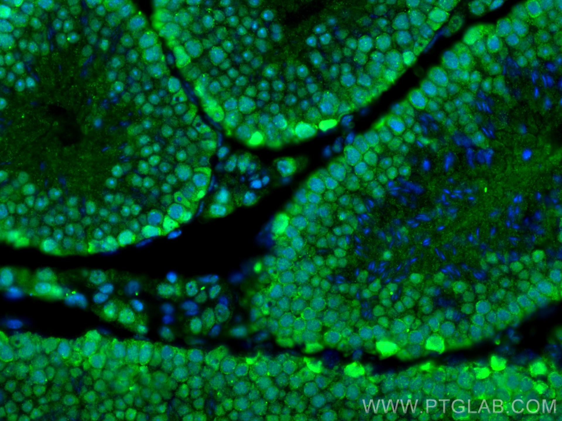 IF Staining of mouse testis using 13371-1-AP