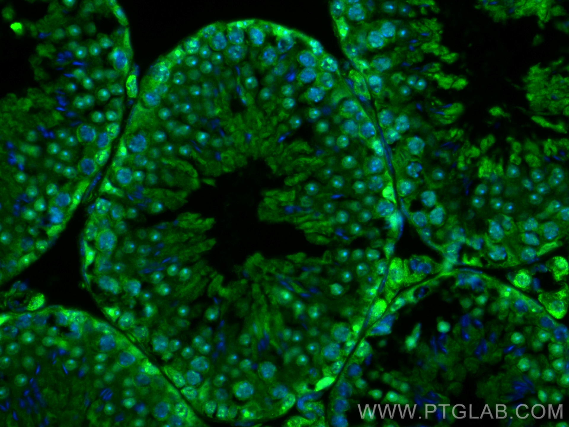 IF Staining of mouse testis using CL488-80174