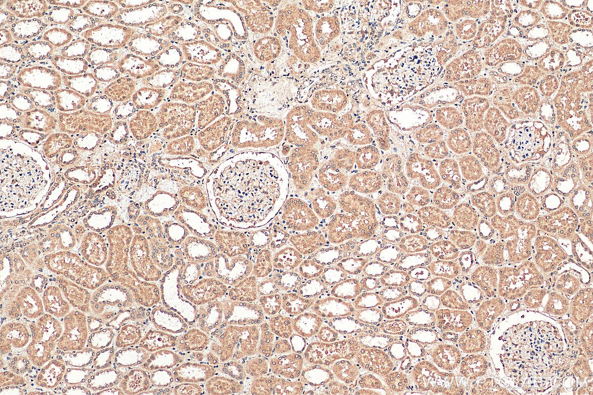 IHC staining of human kidney using 16692-1-AP