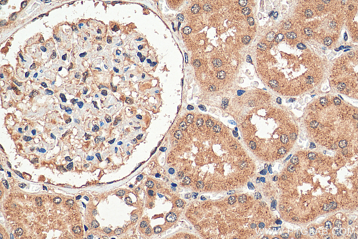 IHC staining of human kidney using 16692-1-AP