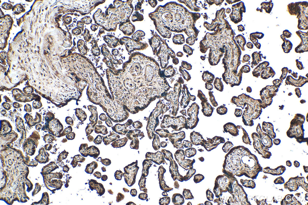 IHC staining of human placenta using 30127-1-AP (same clone as 30127-1-PBS)