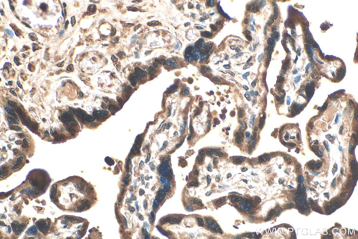 IHC staining of human placenta using 30127-1-AP (same clone as 30127-1-PBS)