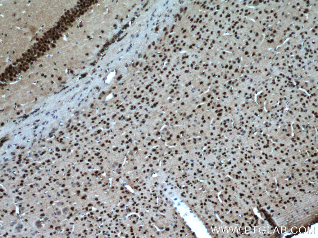 IHC staining of mouse brain using 20555-1-AP