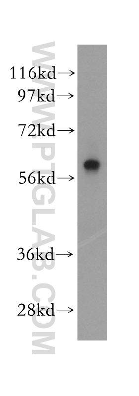 WB analysis of human kidney using 11289-1-AP