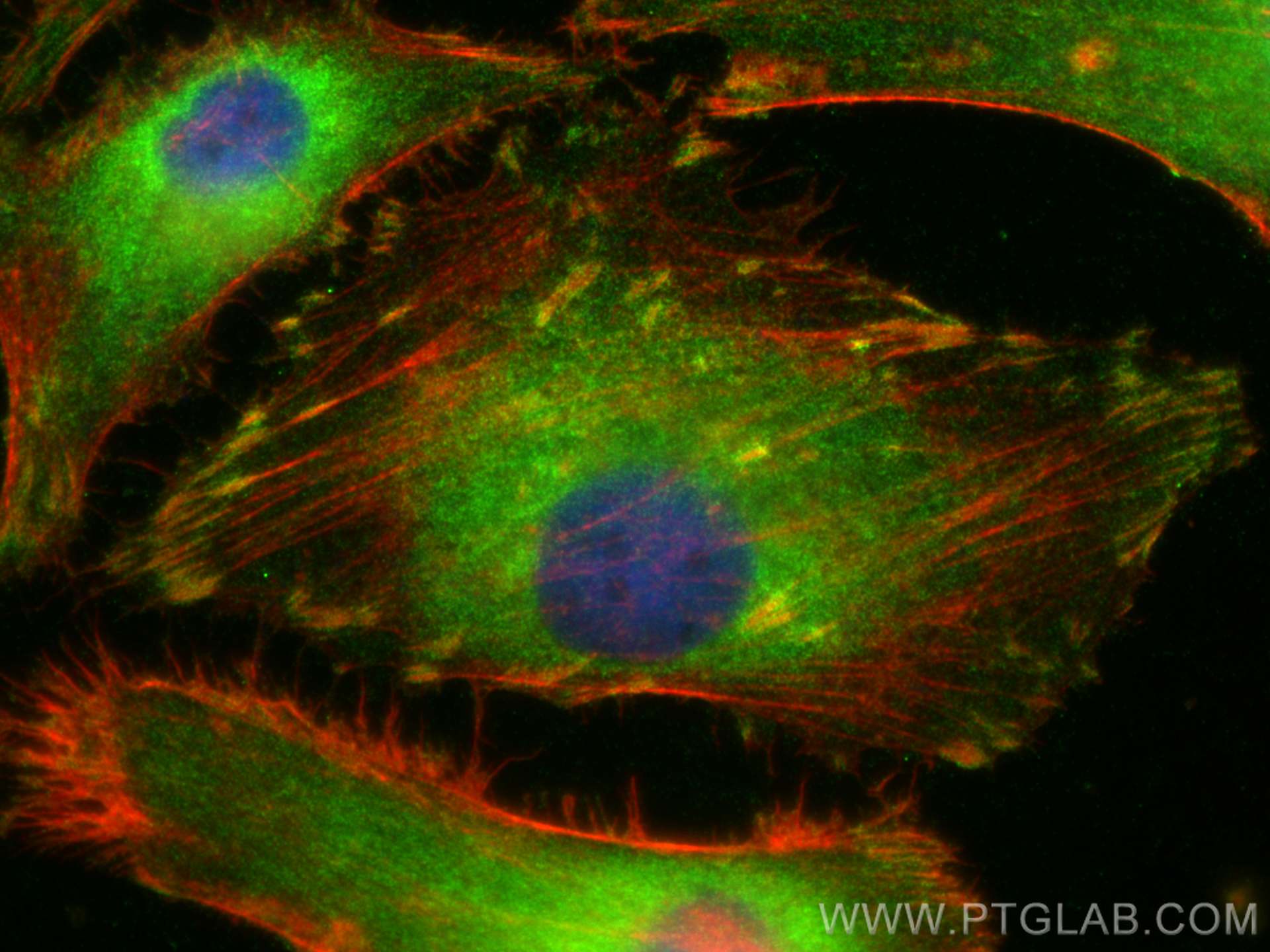 IF Staining of HeLa using 14463-1-AP