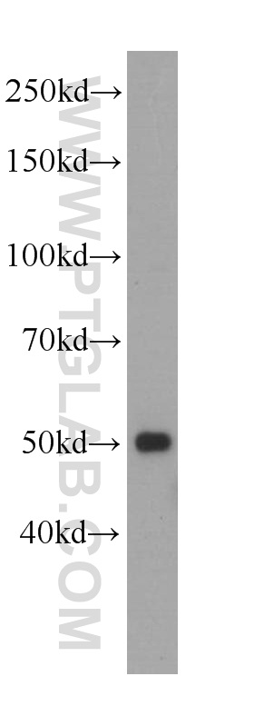 WB analysis of K-562 using 60217-1-Ig