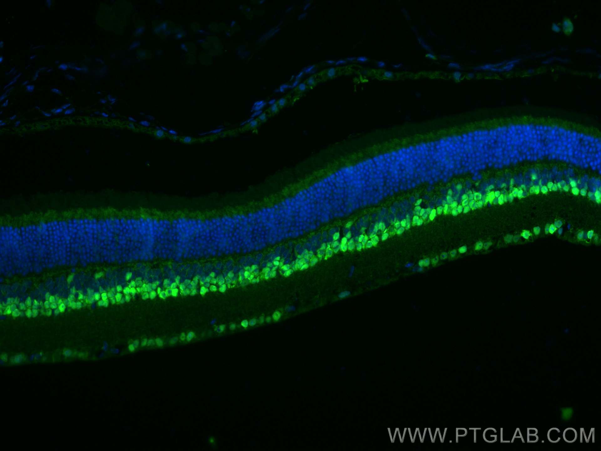 IF Staining of mouse eye using 12323-1-AP