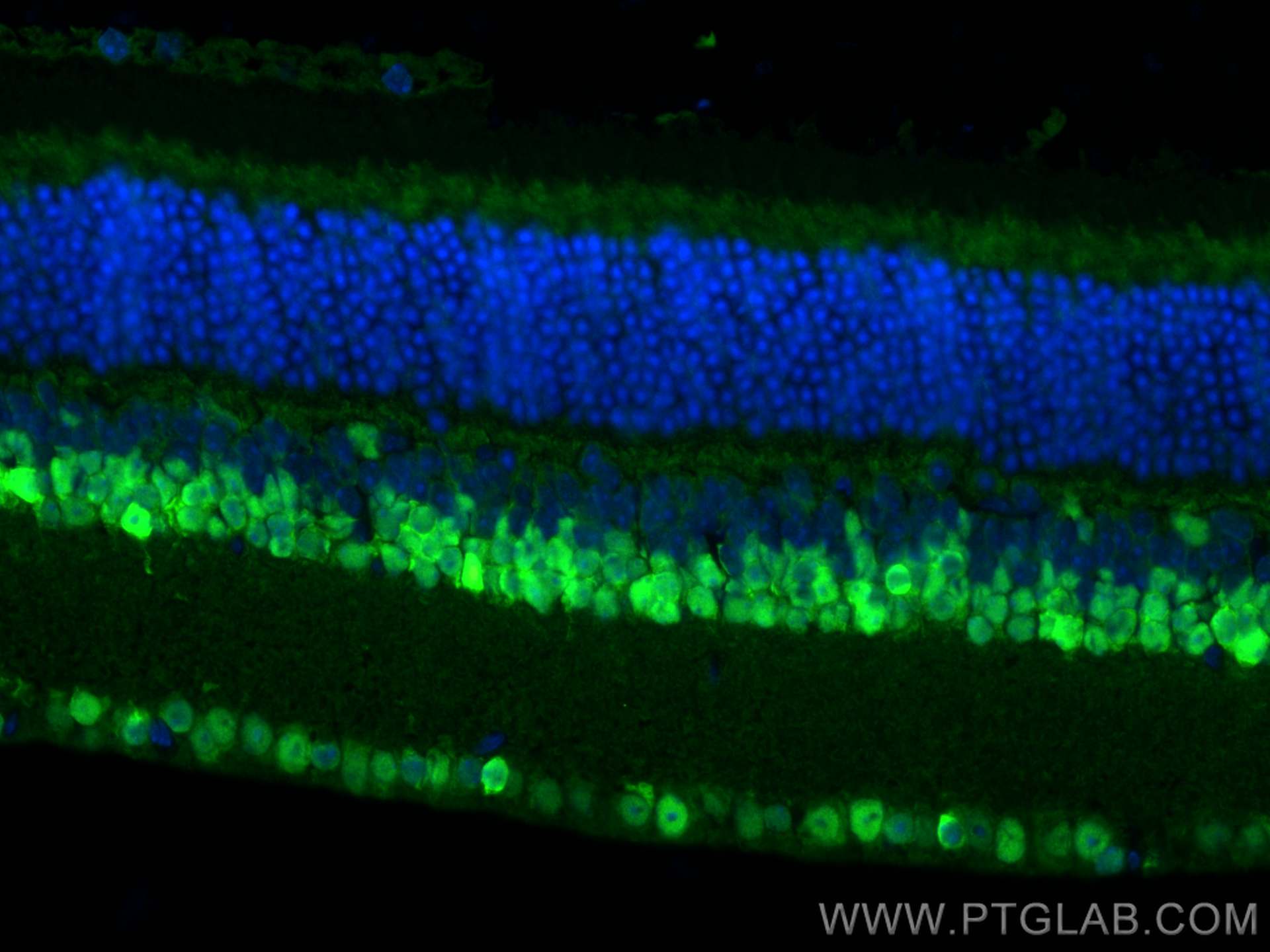 IF Staining of mouse eye using 12323-1-AP