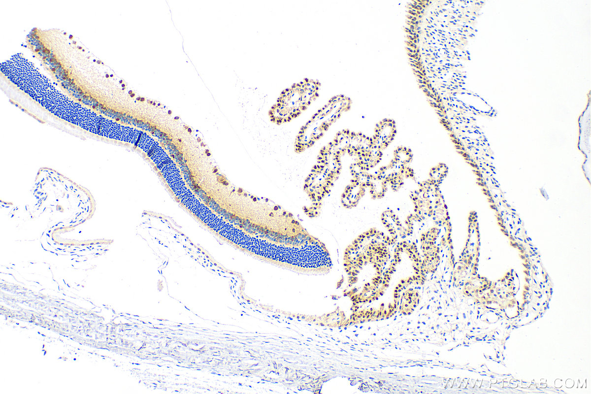 IHC staining of rat eye using 12323-1-AP