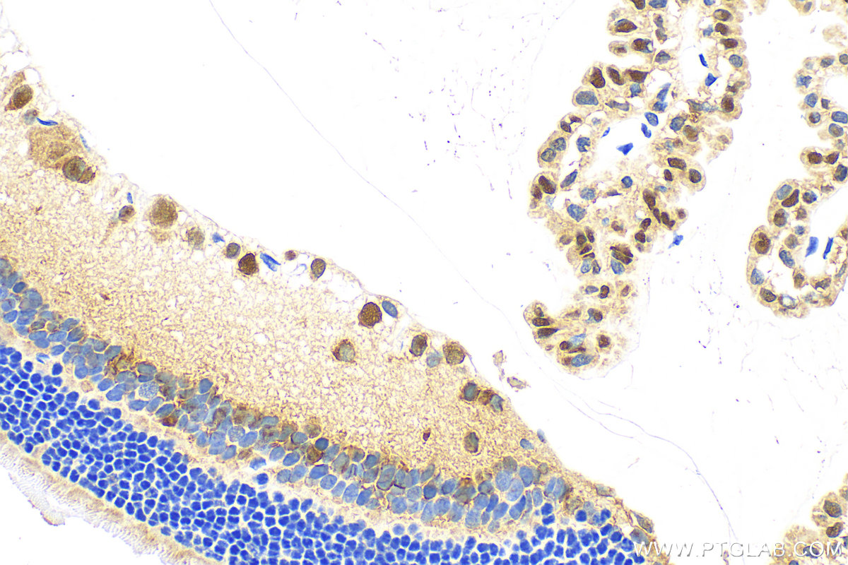 IHC staining of rat eye using 12323-1-AP