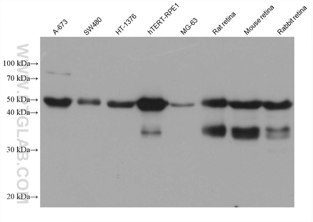 WB analysis using 67529-1-Ig (same clone as 67529-1-PBS)