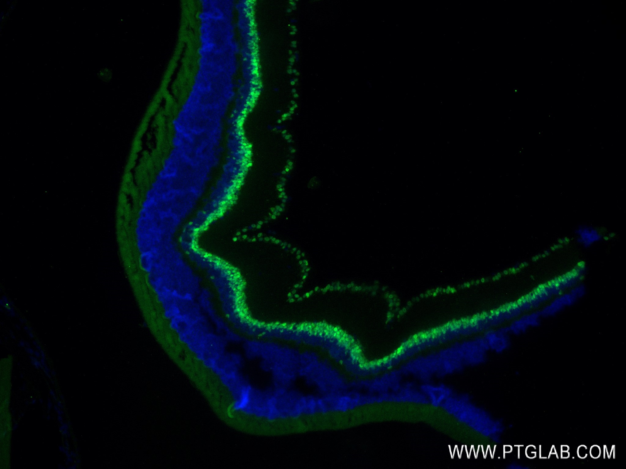 IF Staining of mouse eye using 84345-5-RR