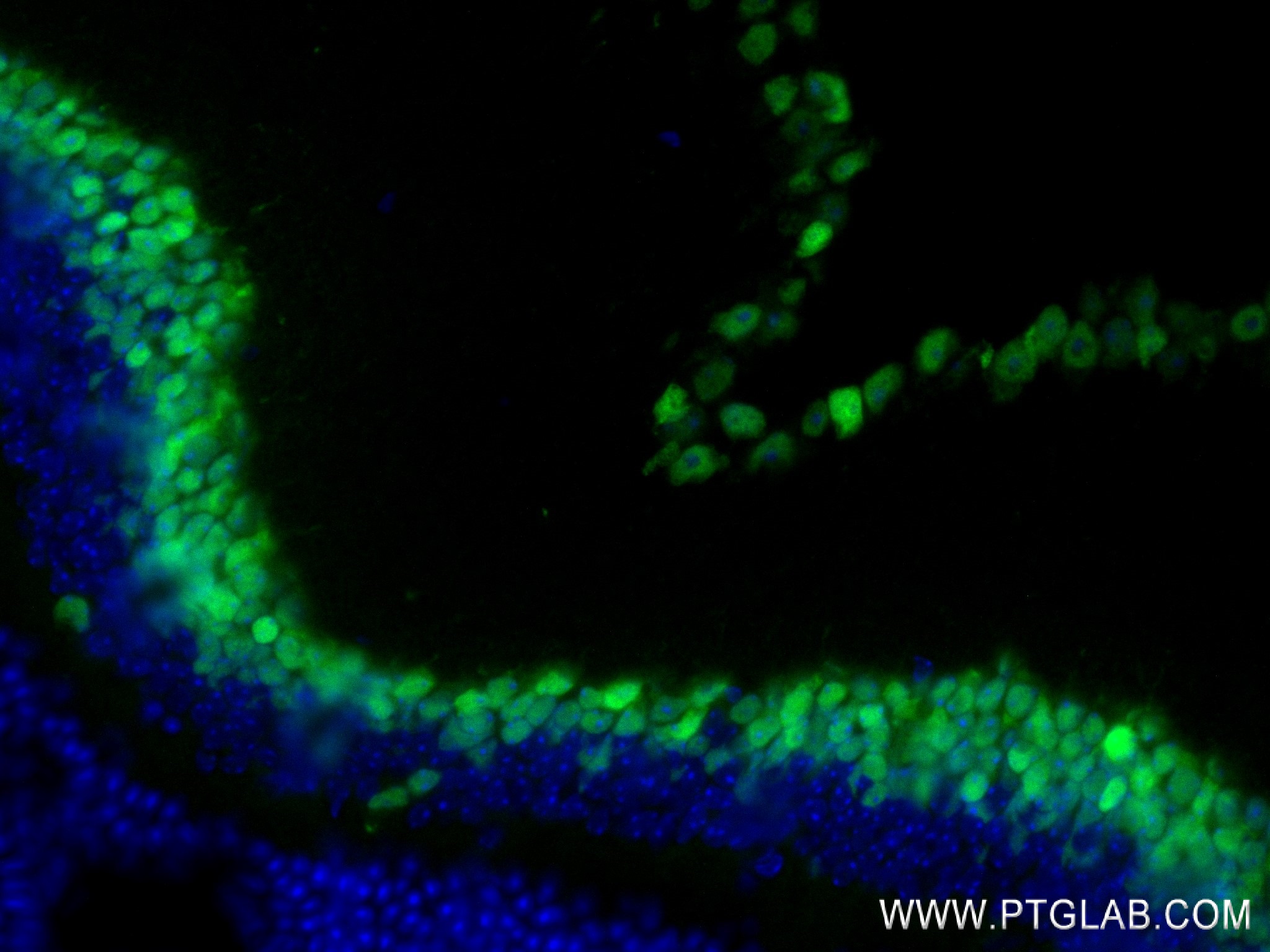 IF Staining of mouse eye using 84345-5-RR