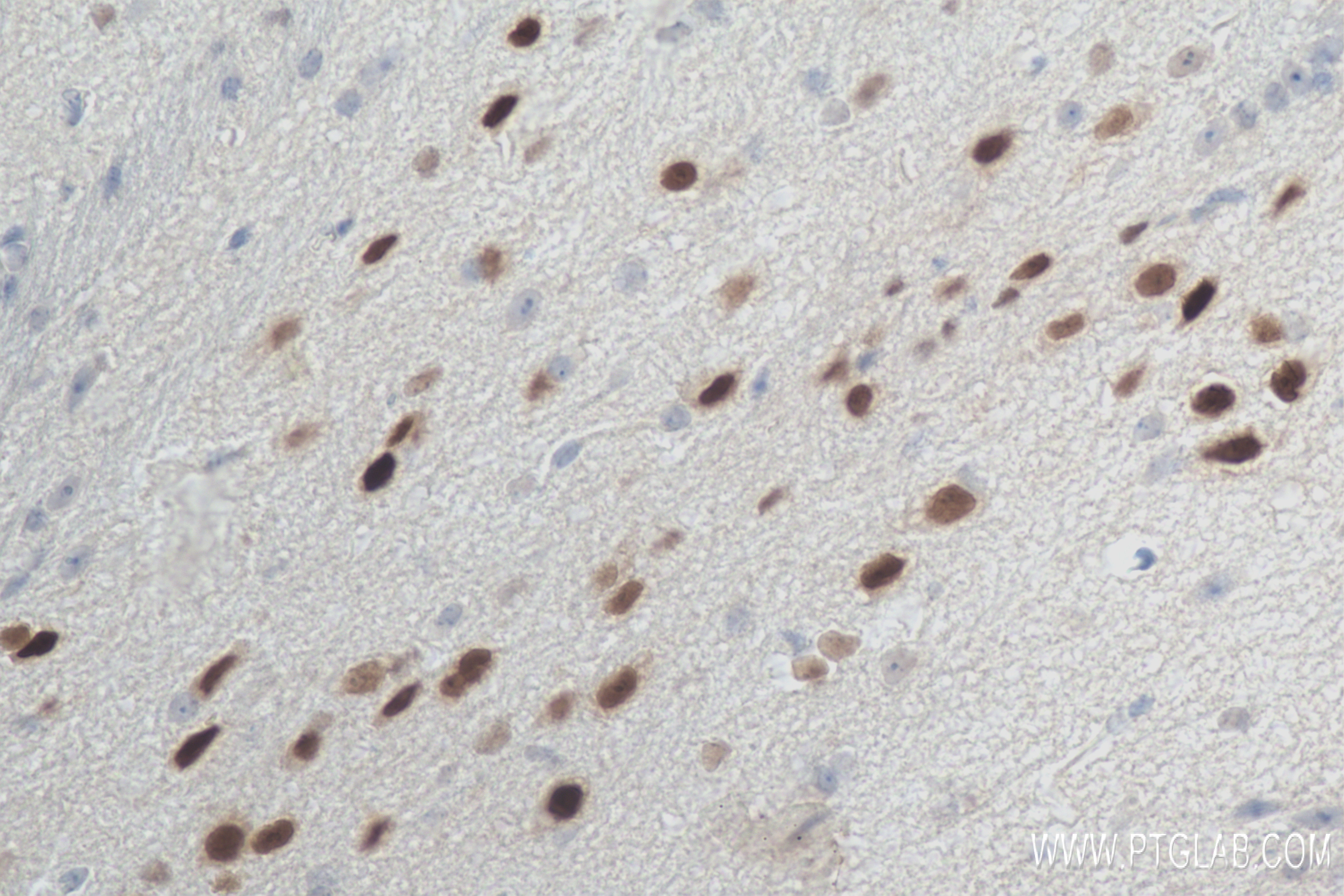 IHC staining of mouse brain using 84345-5-RR (same clone as 84345-5-PBS)