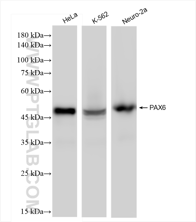 WB analysis using 84345-5-RR (same clone as 84345-5-PBS)