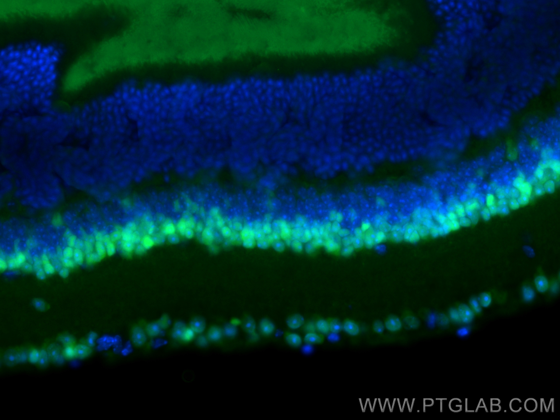 IF Staining of mouse eye using CL488-12323