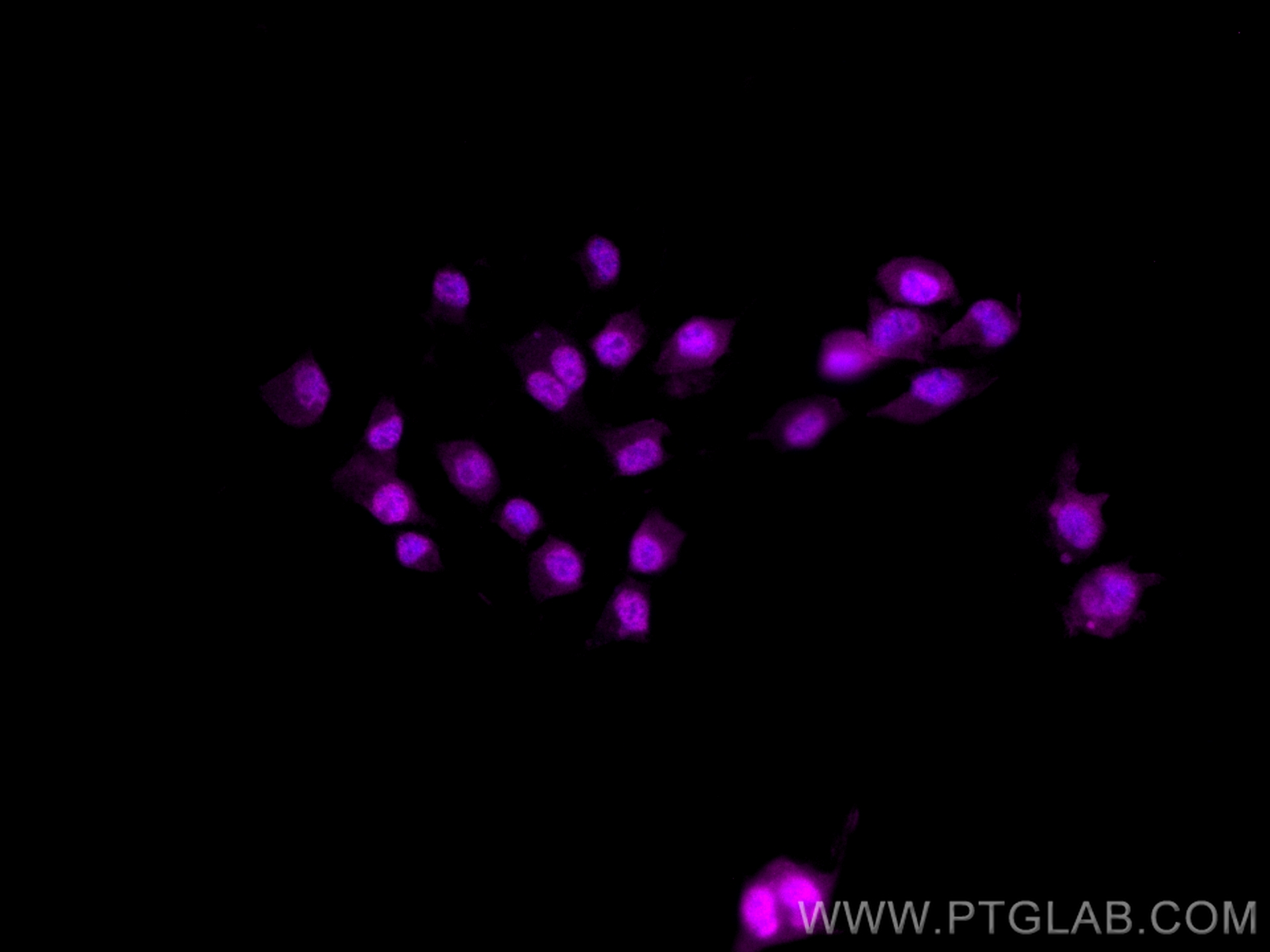 IF Staining of Neuro-2a using CL647-12323